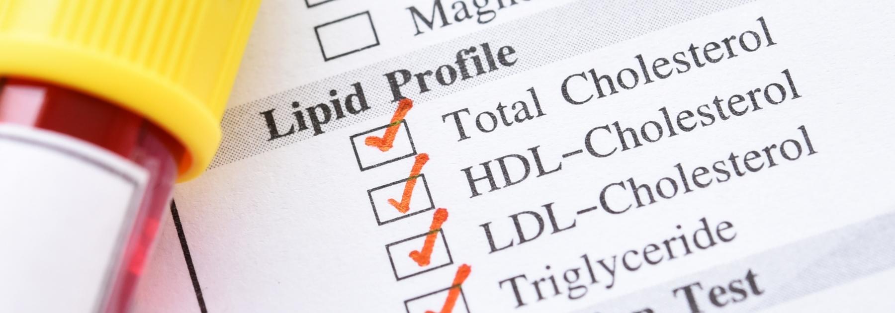 Cholesterol testing